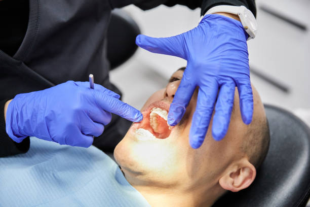 Best Emergency Denture Repair in Batavia, NY